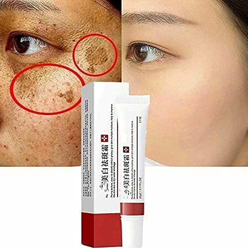VoaiBekt Crema blanqueadora para pecas elimina el Melasma manchas oscuras aclara la piel