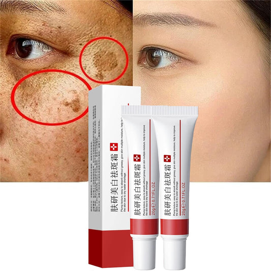 2 Pcs Whitening Freckle Cream, Acne Scar Removal Treatment Cream, Pigmentation Removal Cream for Face, Moisturizing Removes Facial Melasma Dark Spots Wrinkles Blemishes (whitening freckle cream)